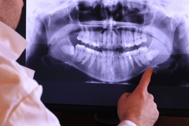 Best Cracked Tooth Emergency Dentist  in Elwood, UT